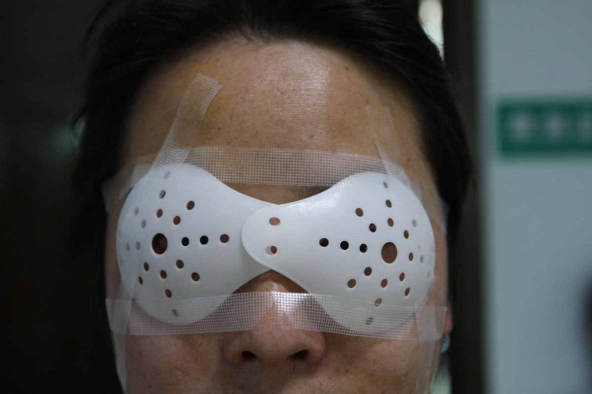 热敷眼罩治疗睑板腺功能障碍：预期临床疗效