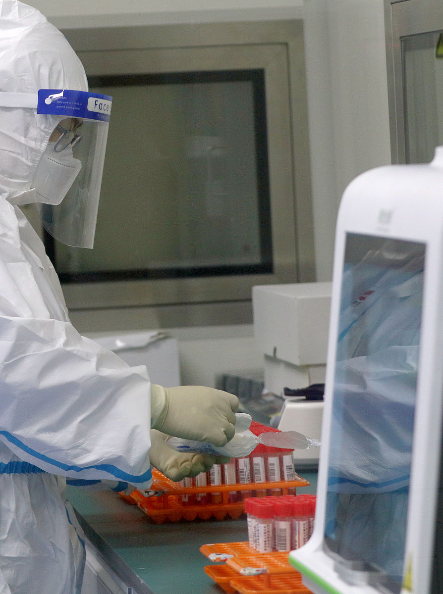 鹦鹉热衣原体的实验室诊断方法有哪些？