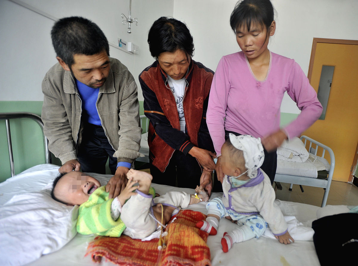 神经内科双氢克尿噻救治脑出血患者的机制