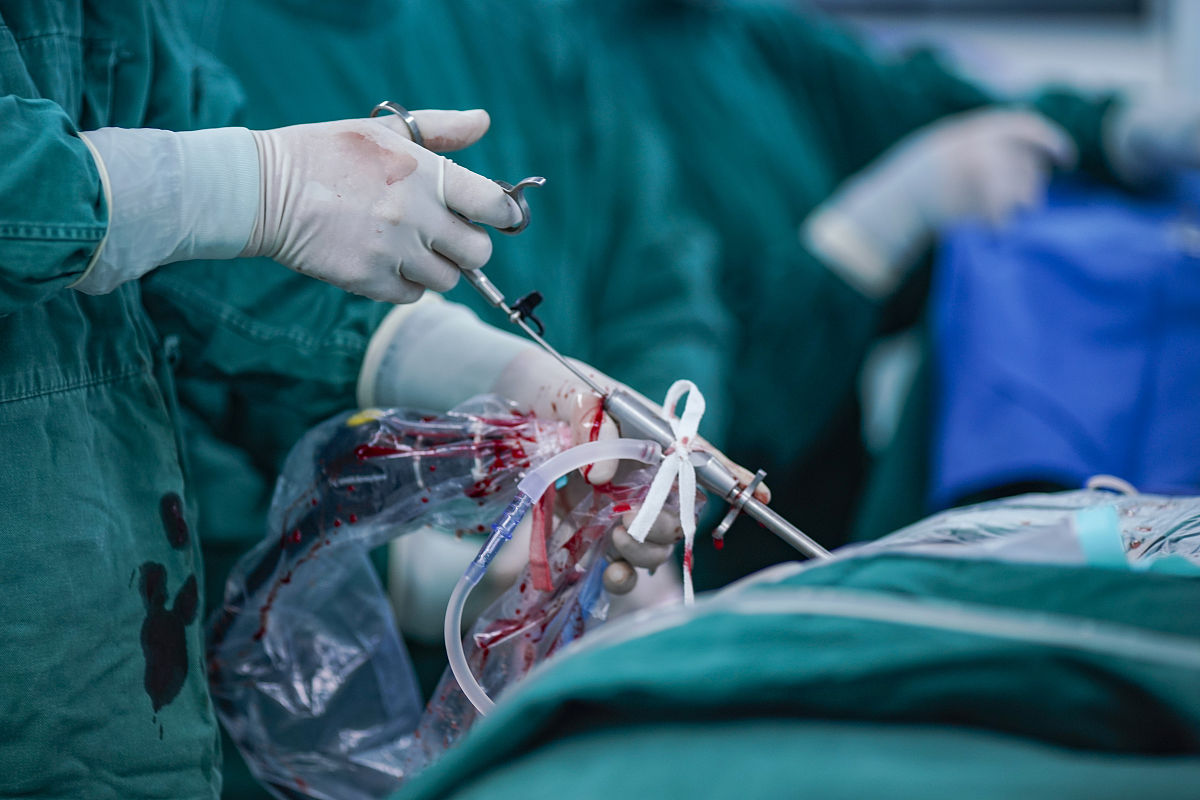 腹腔镜手术的应用范围是哪些手术