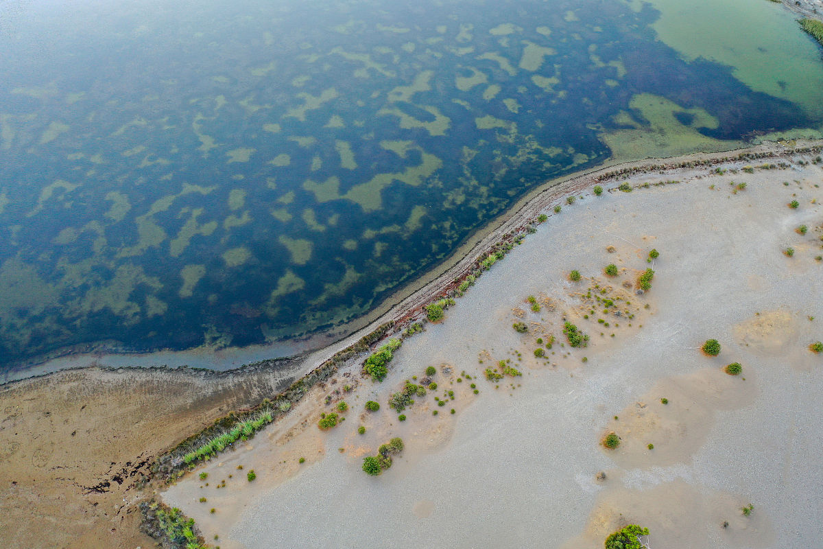 脑梗死的康复训练护理学=