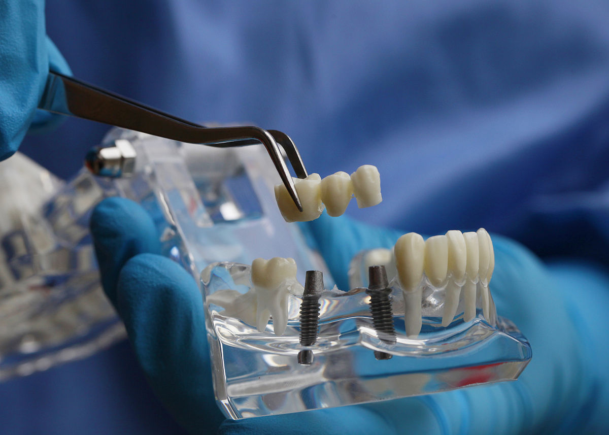 集采种植牙质保延保申请书：保障患者权益，促进民营医院发展