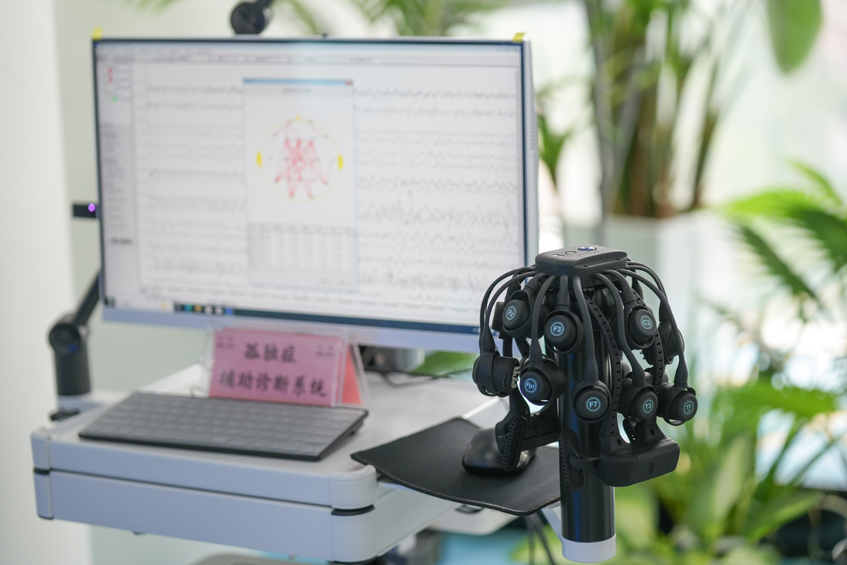 头皮脑电测量原理详解 - 揭秘大脑的电信号