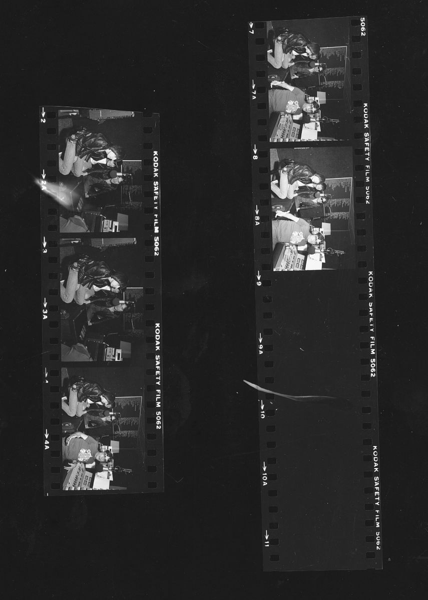 颈内动脉斑块破裂导致的FFT：一个罕见病例的报道