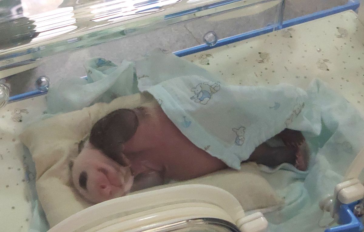 孕妇怀双胞胎或多胞胎能用无痛分娩吗？