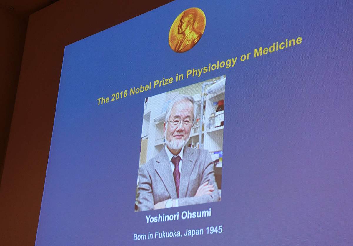 尿酸的相关研究课题有哪些？