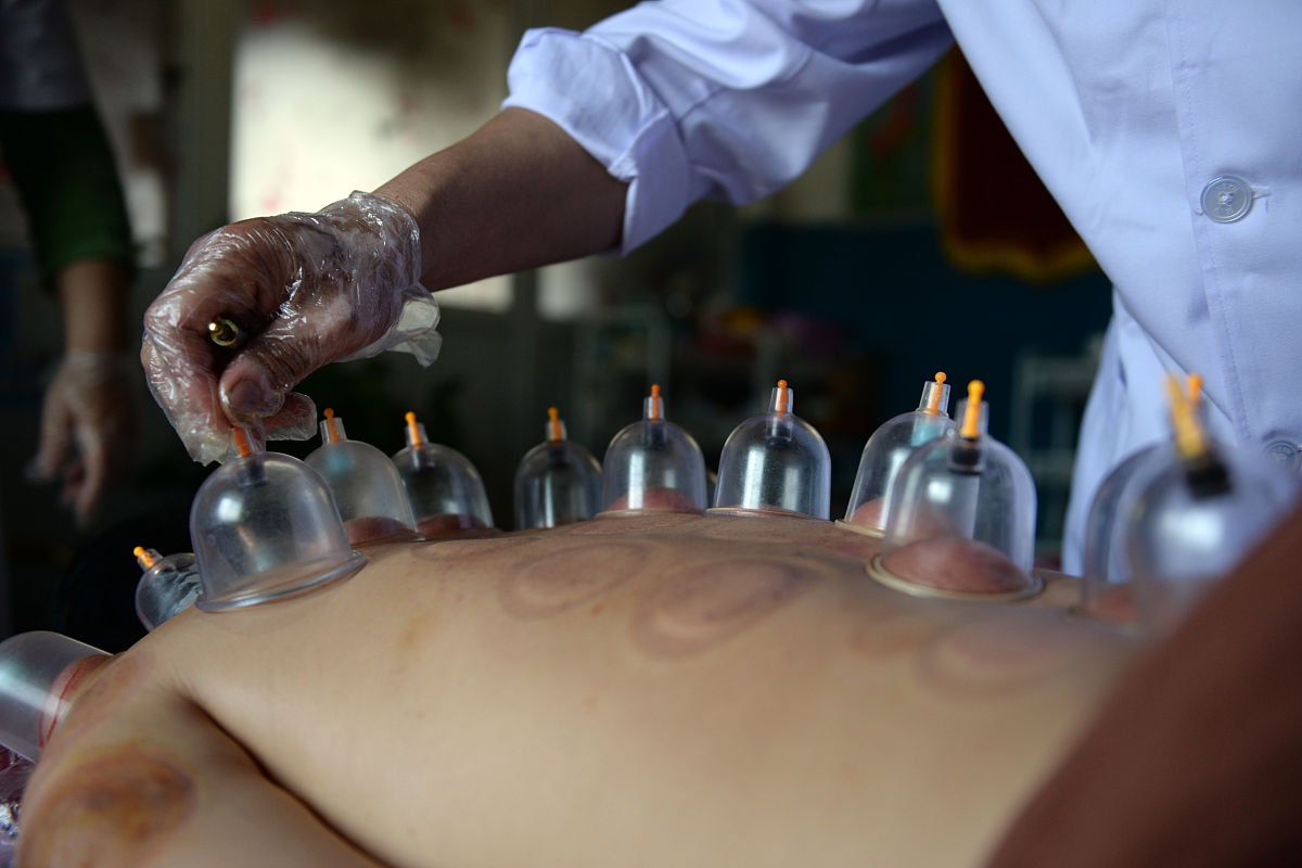 在西安想学习中医理疗拔罐针灸那个学校比较靠谱