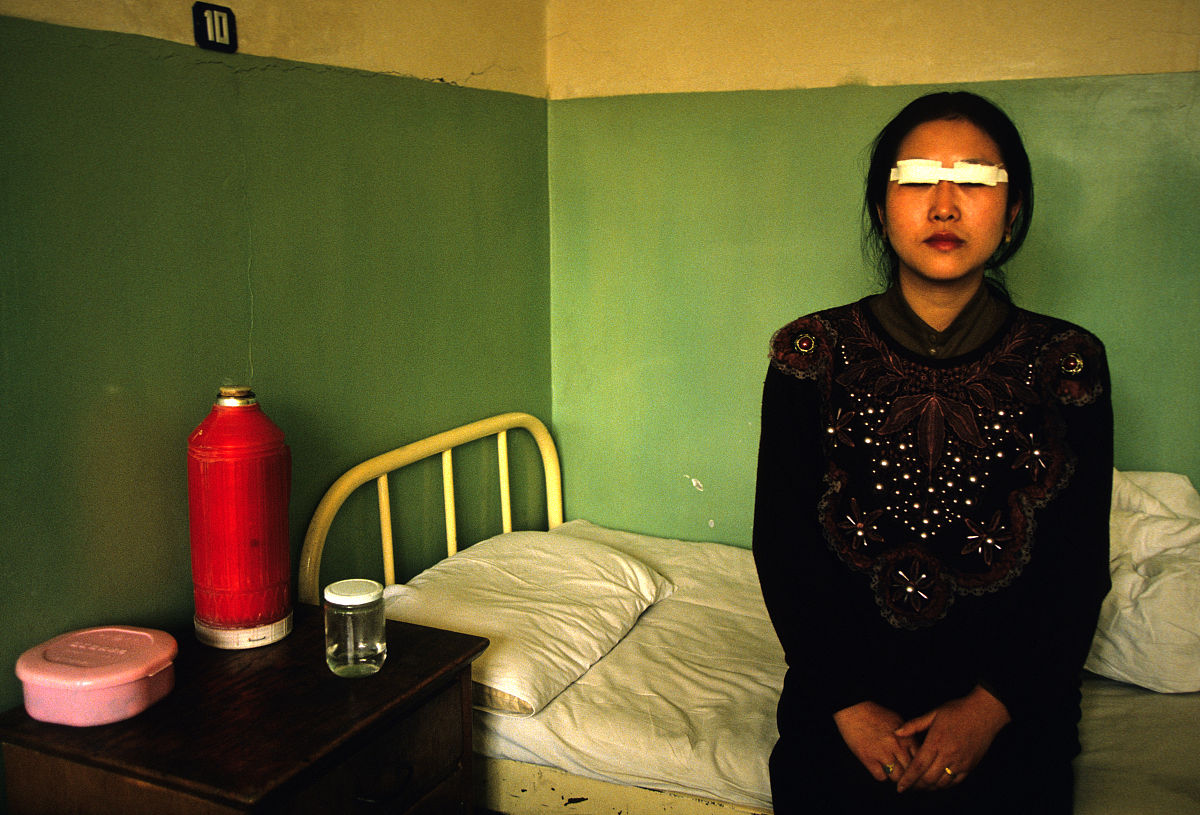 什么是无痕双眼皮？