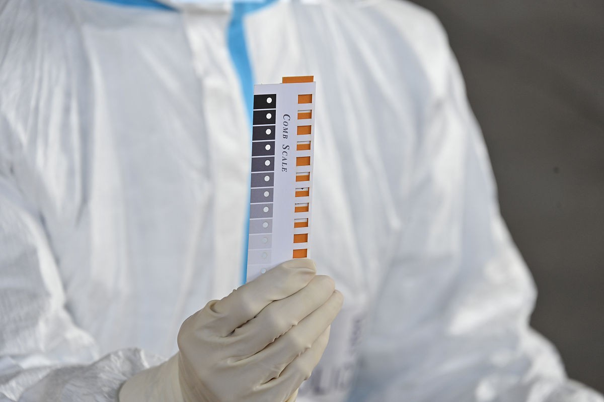 抽血前一天喝啤酒会影响检测结果吗？