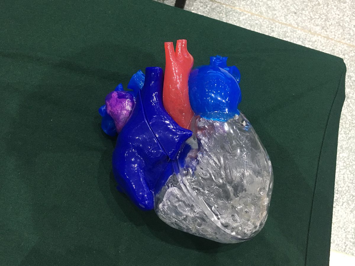 光调控在规模化集成乘法累加运算中的优势