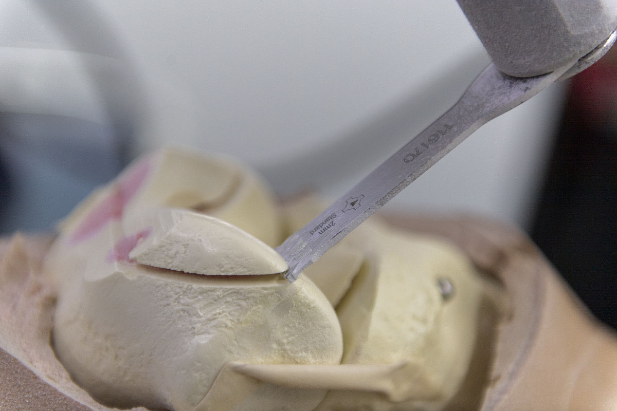 杰哥明天要做腿的矫正手术写不低于200字的祝福