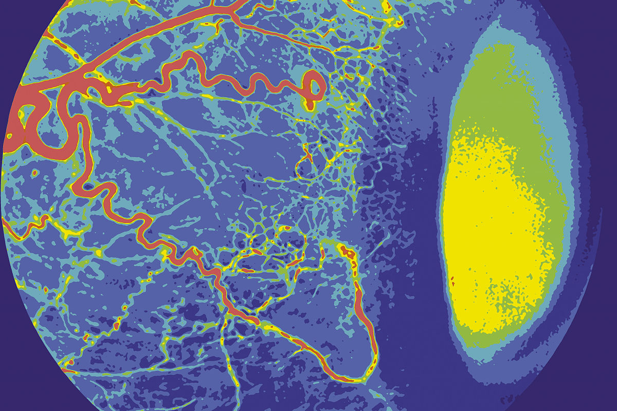 卫星反演再分析波浪数据在台风浪研究中的局限性