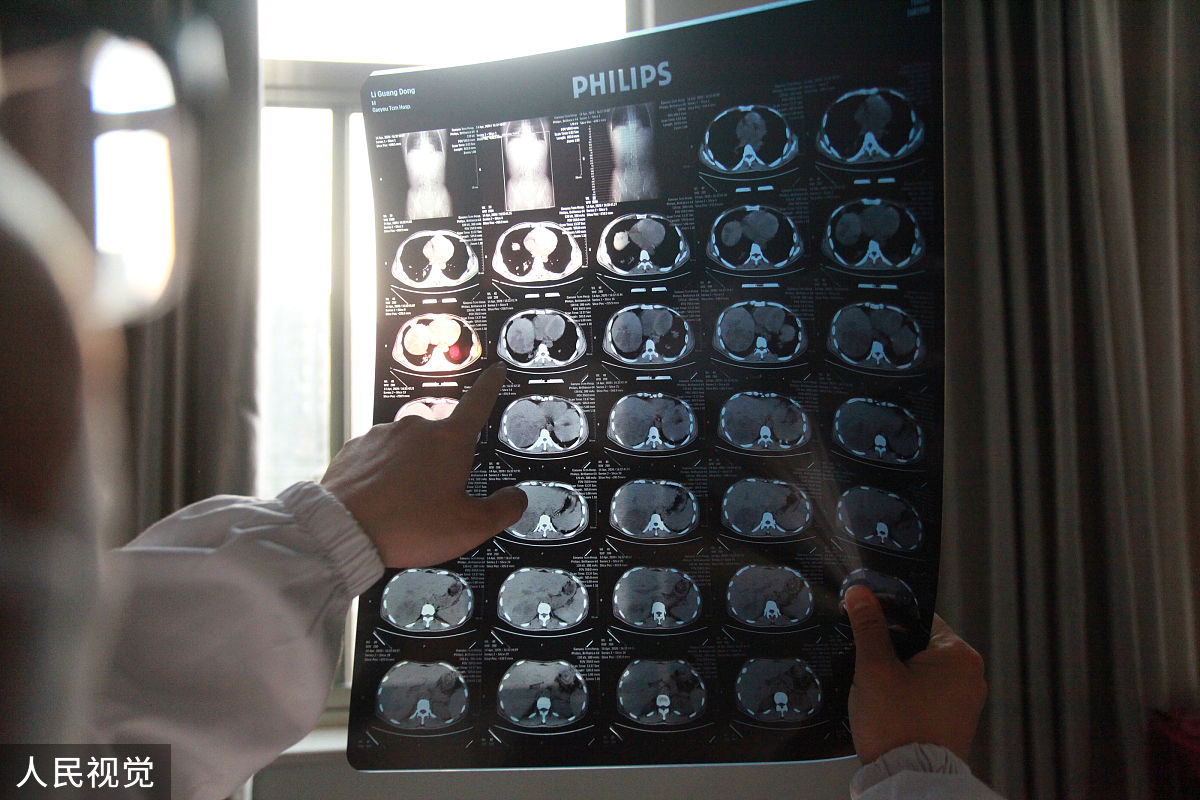 村疫情防控工作总结简短