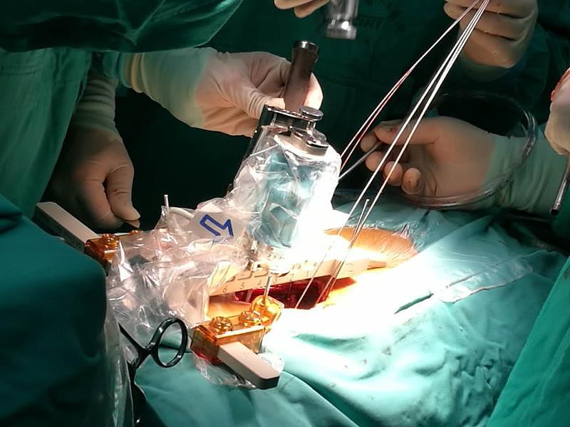 腰椎间盘突出微创治疗：脊柱内镜手术