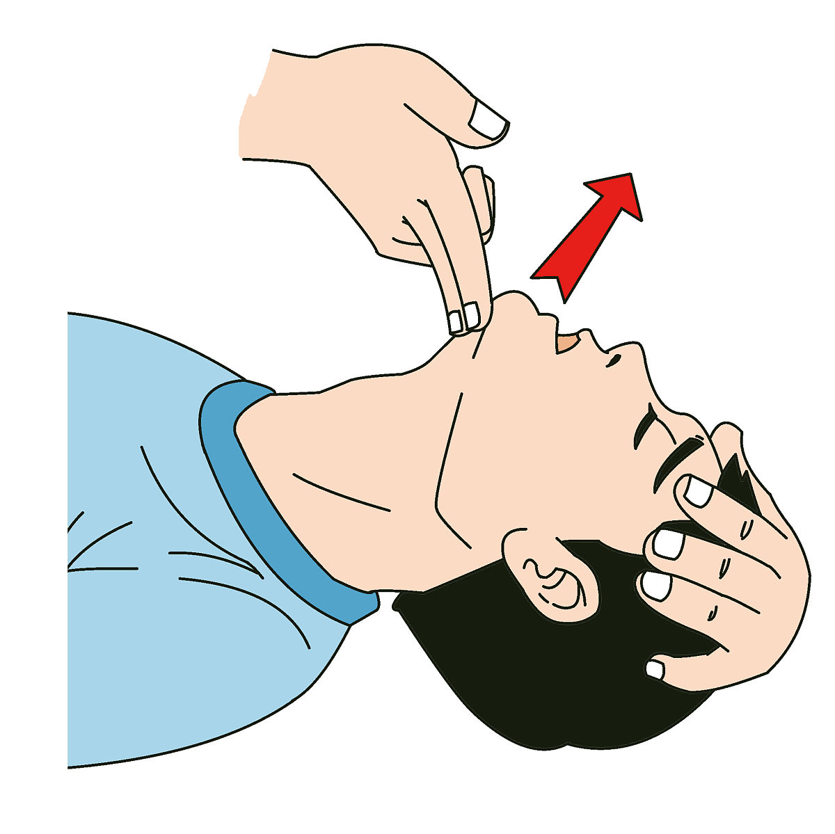 新生儿窒息护理的重要性