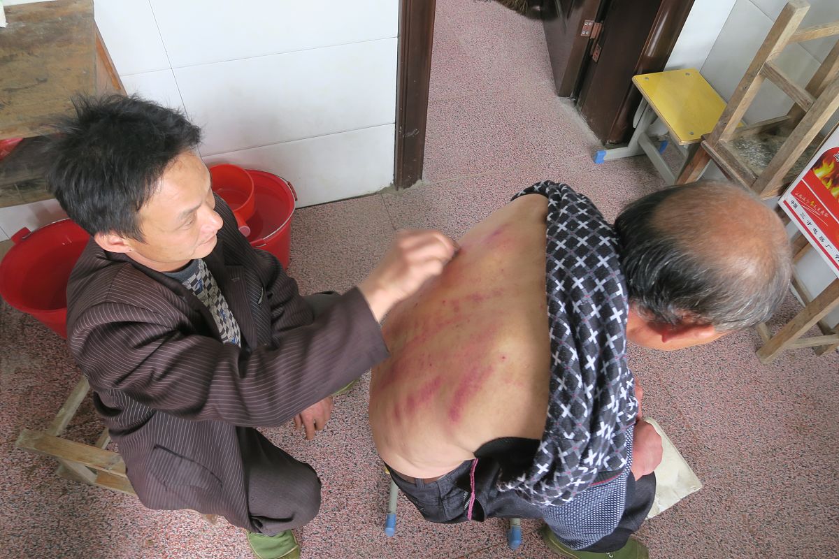 刮痧：传统中医疗法，缓解疼痛，促进健康