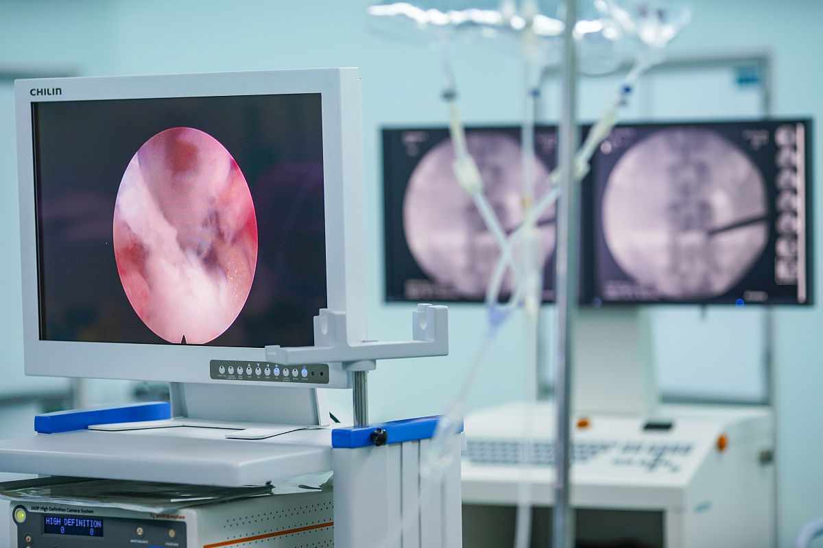 医学突破！超声内镜引导下胰腺囊肿穿刺+双蘑菇头金属支架引流术成功实施