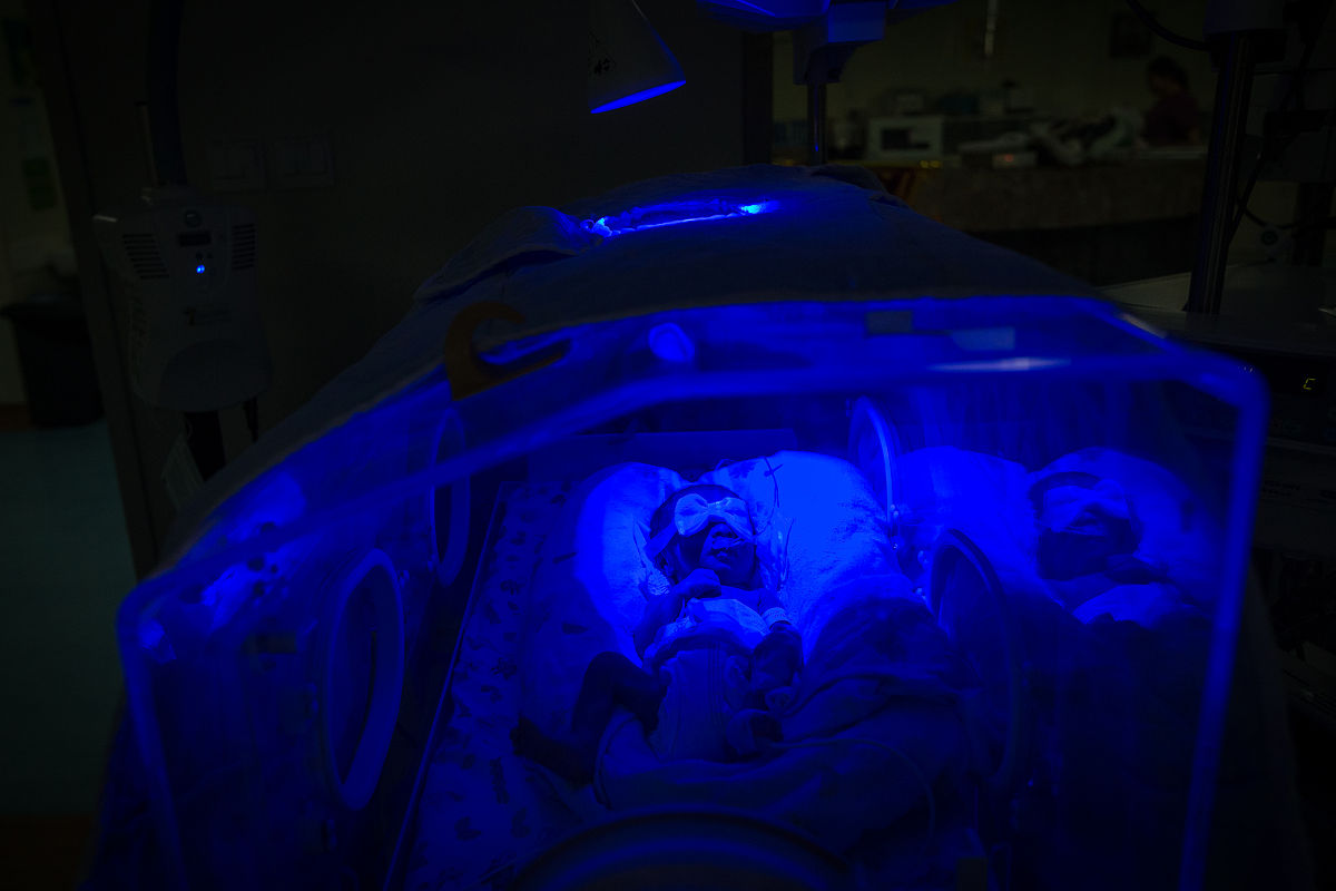 黄疸治疗费用：每天花费多少？