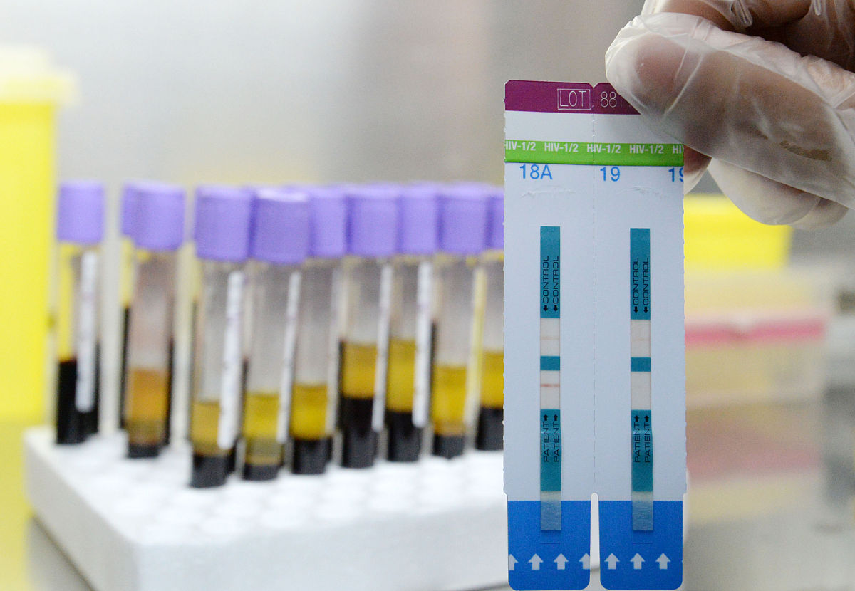 为什么HIV检测偏向p24抗原而不是gp120抗原？