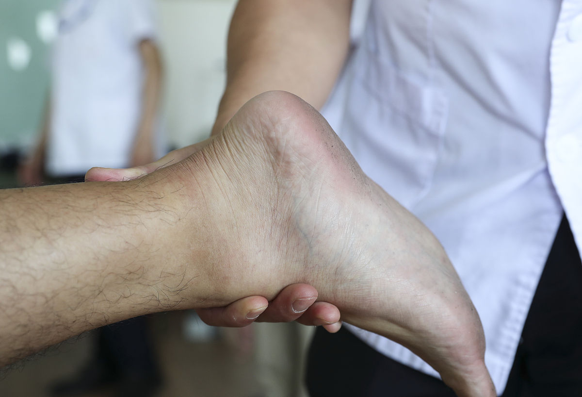 尿酸过高导致通风怎么办