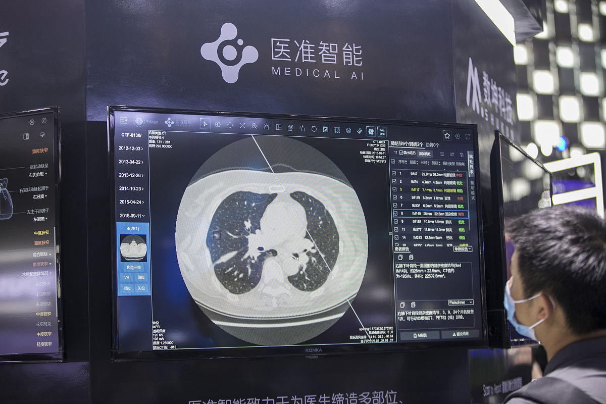 关于肺结节深度学习的综述左右