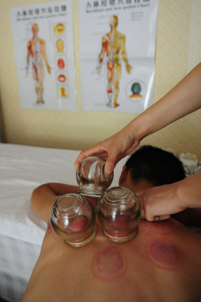 黄帝内经治腰痛：针灸、调理肝肾、生活习惯和保暖