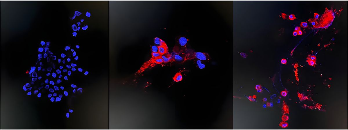 Nuclear Cytoplasmic Transport in English: 