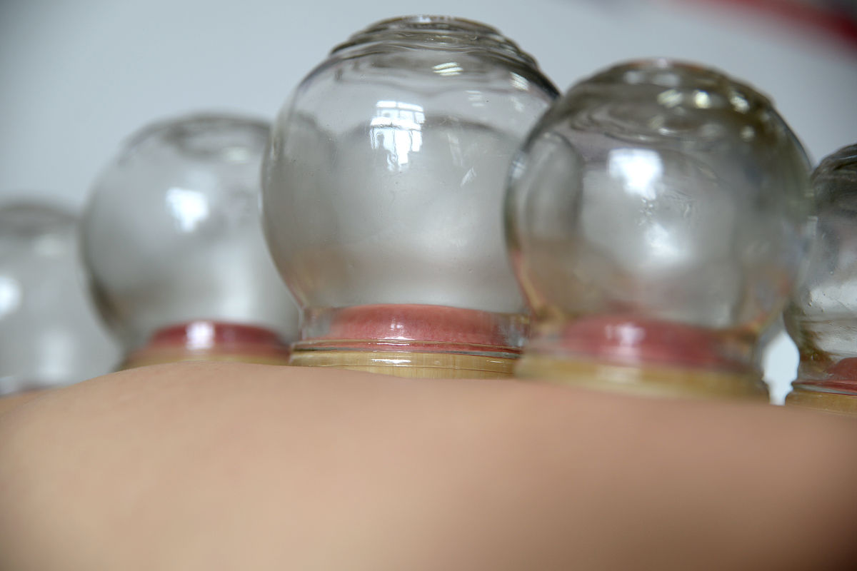 拔火罐吸盘的功效与作用