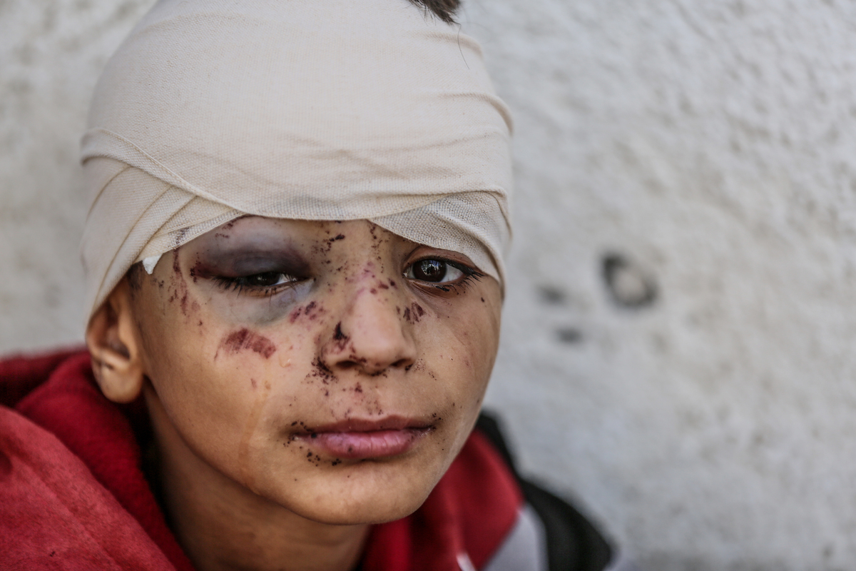 战争对生命的影响：痛苦、丧失和不确定性