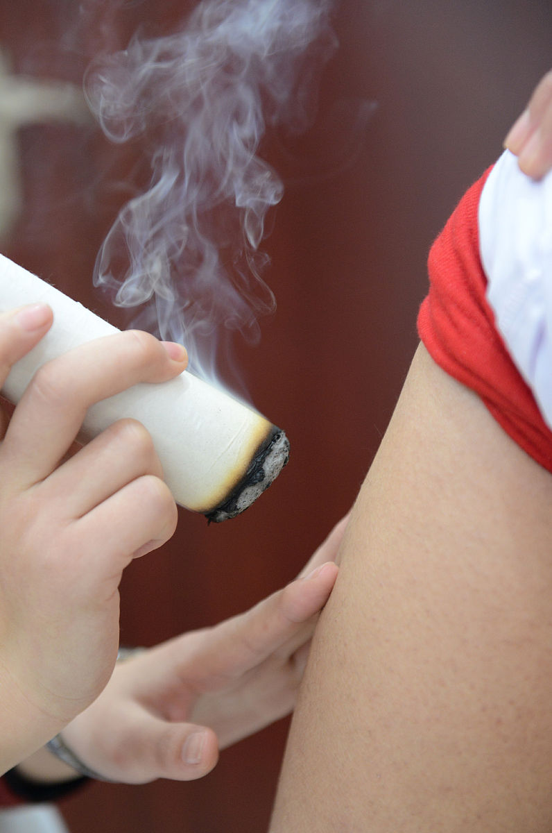 艾灸后常见反应：红肿、瘀斑、疼痛等，正常吗？