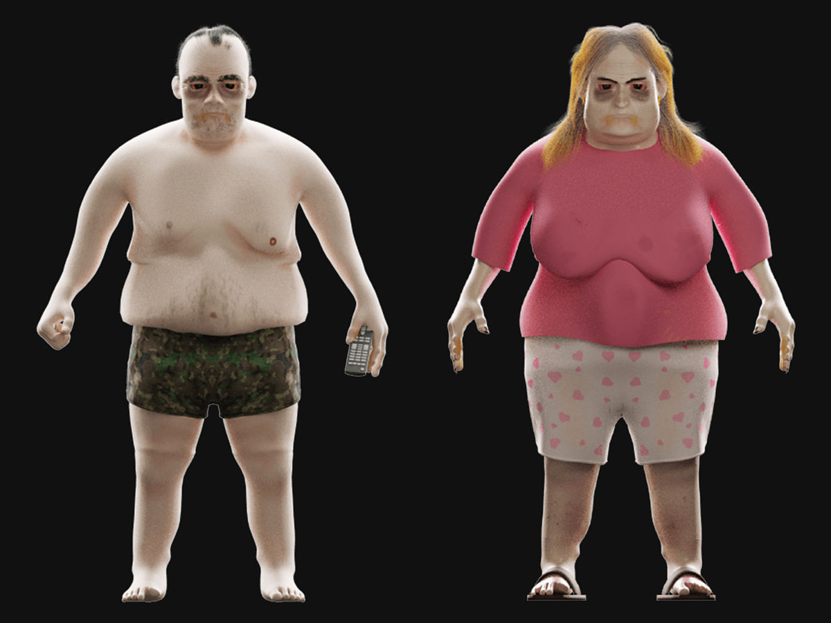 肌肉紧张综合症怎么治疗效果好肌肉紧张综合症的治疗需要综合考虑病因和临床表现常用的治疗方法包括：1 药物治疗：可以使用肌肉松弛剂、非甾体消炎药、镇痛剂等药物来缓解疼痛和肌肉紧张。2 物理治疗：包括按摩、热敷、针灸、推拿等物理疗法可以缓解紧张的肌肉减轻疼痛。3 运动疗法：适当的伸展运动可以促进血液循环帮助缓解肌肉紧张。4 心理治疗：通过心理咨询、放松训练等方式帮助患者缓解紧张情绪促进身心健康。5 饮食