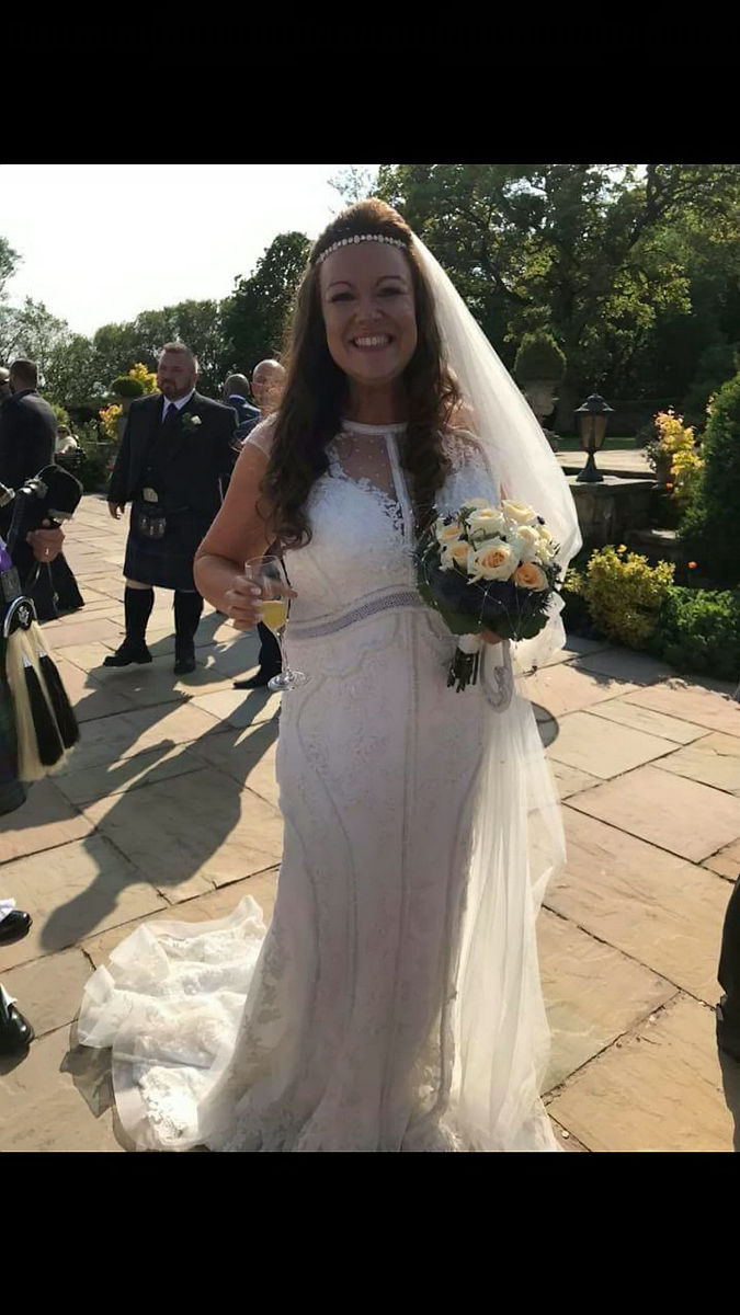 一碗肥肠粉有多少热量，