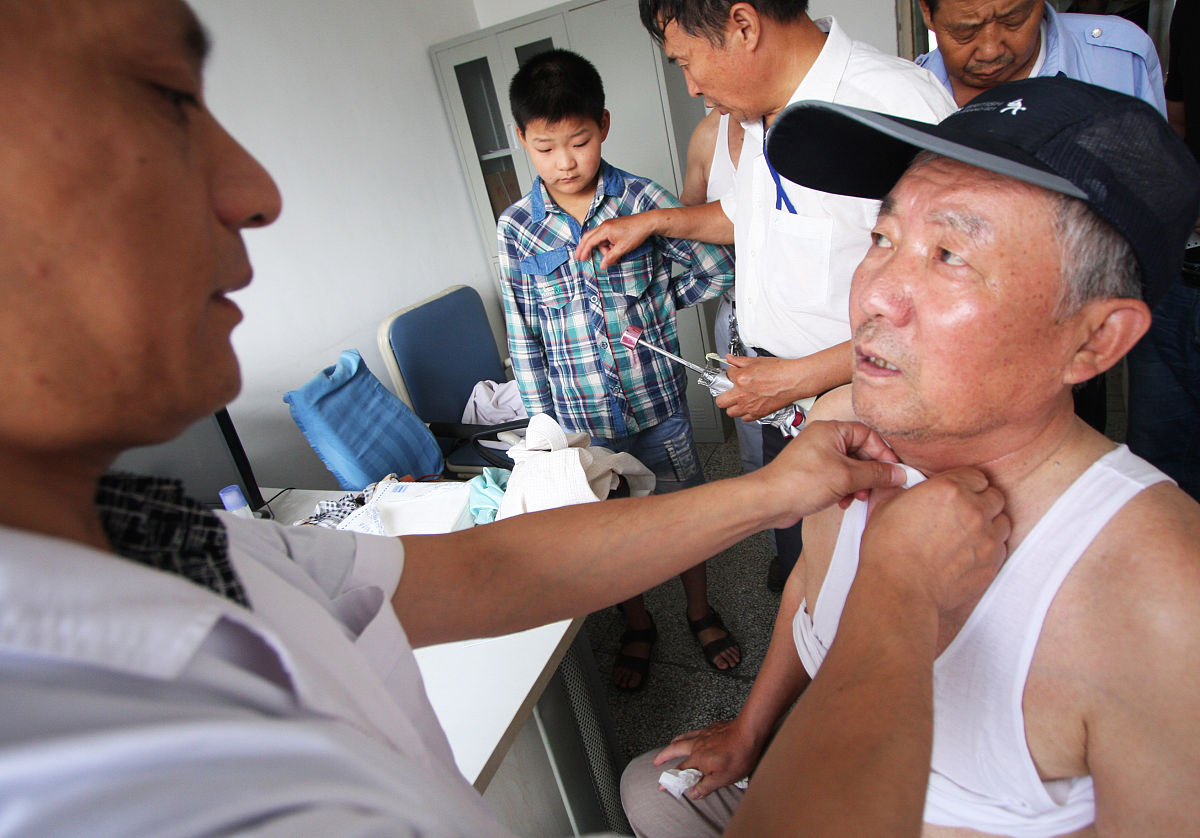 静脉精索稍曲张非手术治疗方法