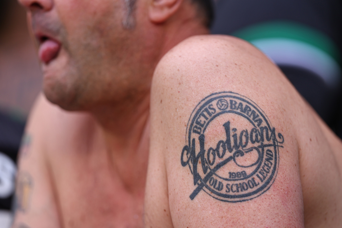 Facial Tattoos, Scars, and Other Conditions Affecting Treatment