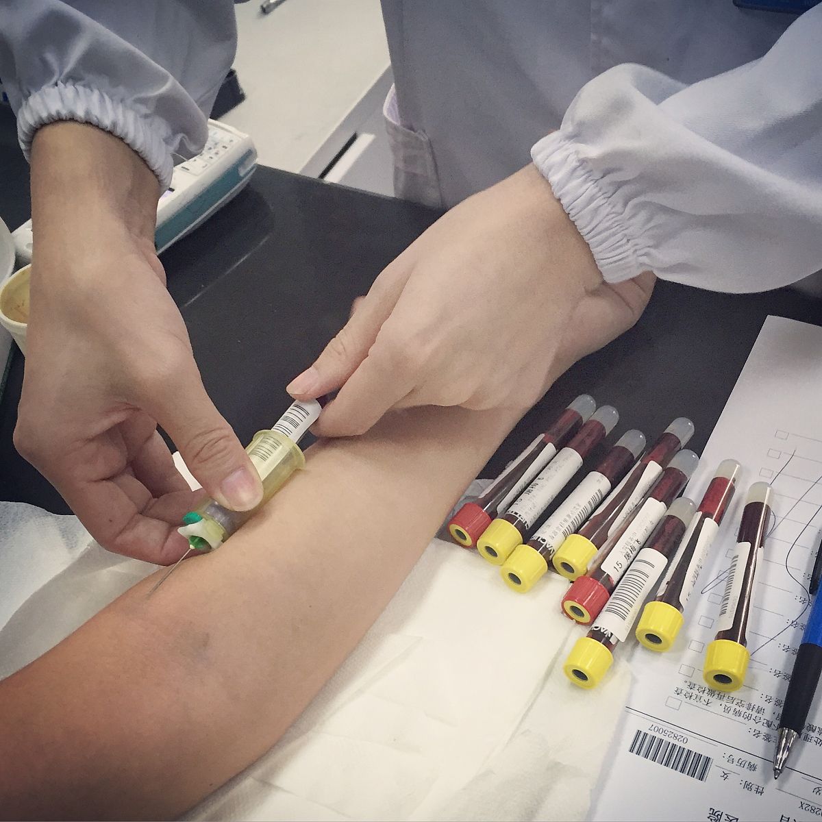 胰岛素笔注射后起包怎么办？原因和处理方法