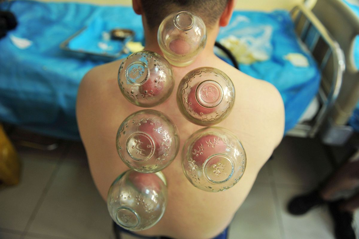 走罐减肥？真相揭秘！300字深度解析