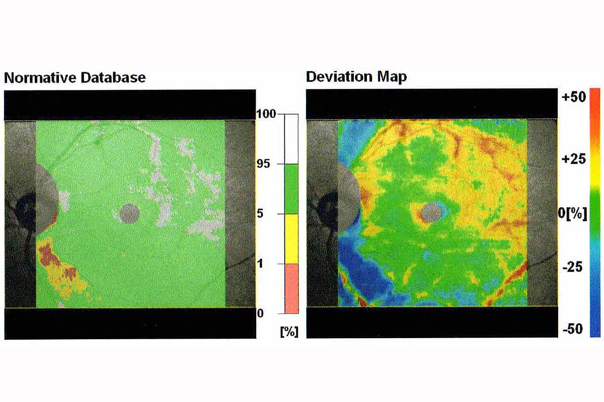 为什么模拟研究中二维多孔介质裂隙渗透率为孔隙渗透率的1000倍而三维中裂隙渗透 为什么模拟研究中二维多孔介质裂隙渗透率为孔隙渗透率的1000倍而三维中裂隙渗透