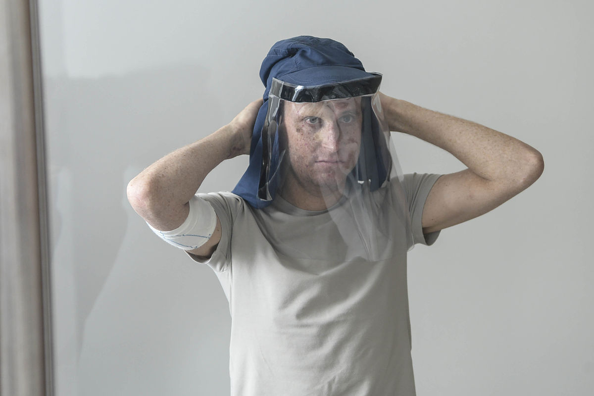 染色体变异和DNA损伤有什么关系