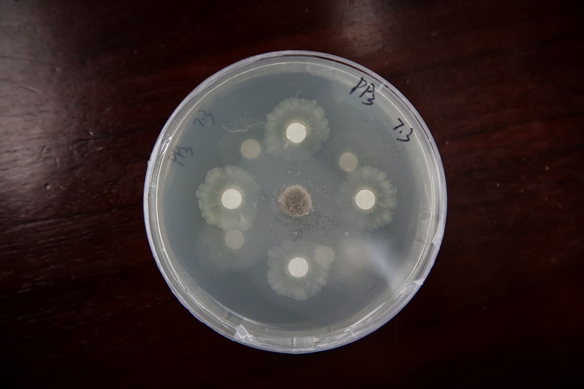 未知菌种鉴定方法：从血平板到分子生物学