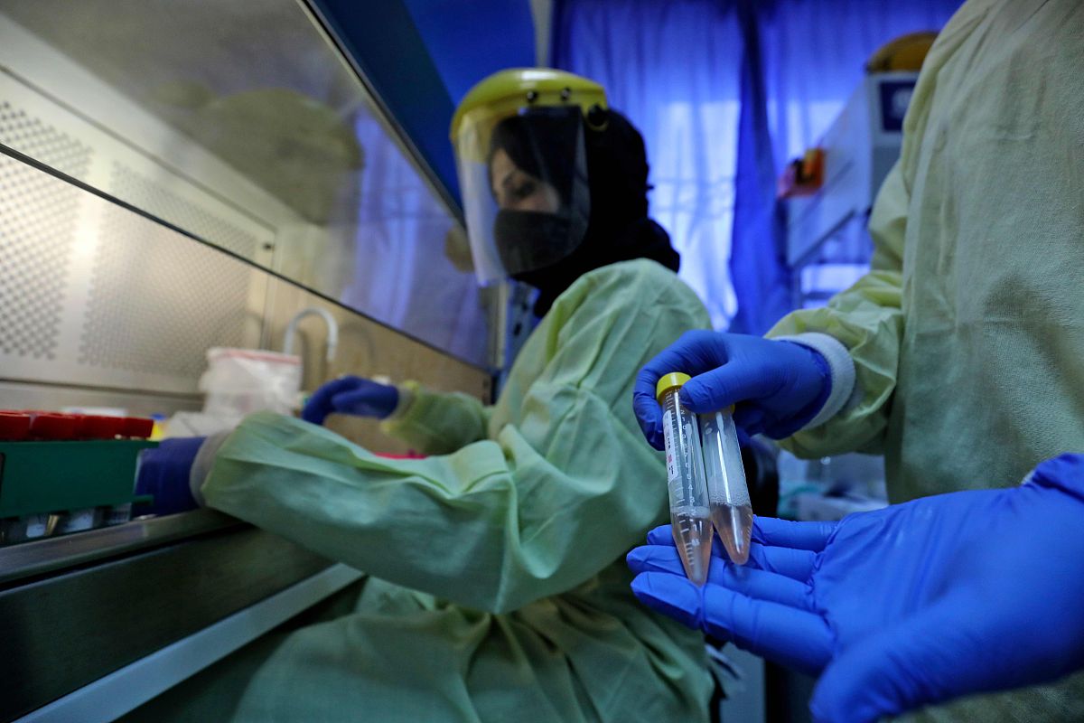 十天检测法：判断狂犬病毒感染的可靠方法？