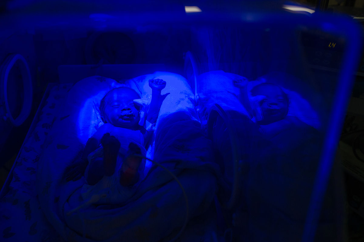 黄疸治疗费用：每天花费多少？