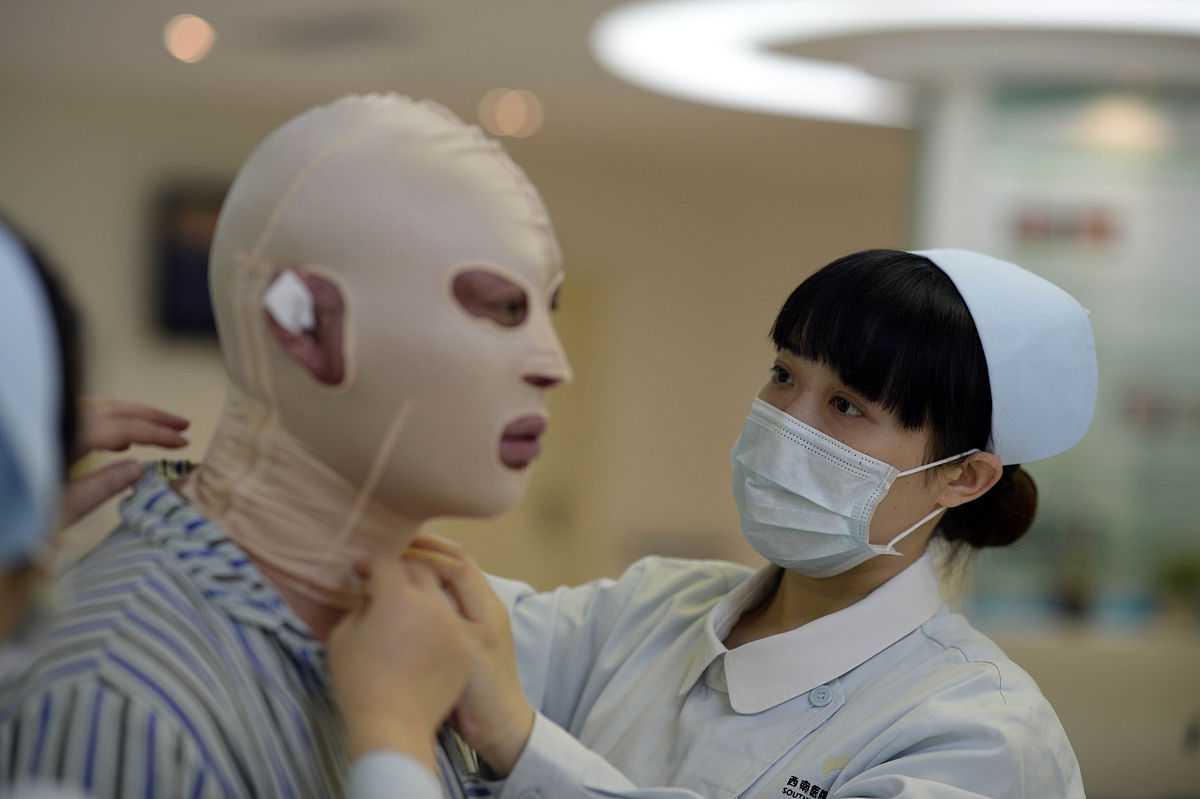 特重度烧伤护理：全面指南及最佳实践