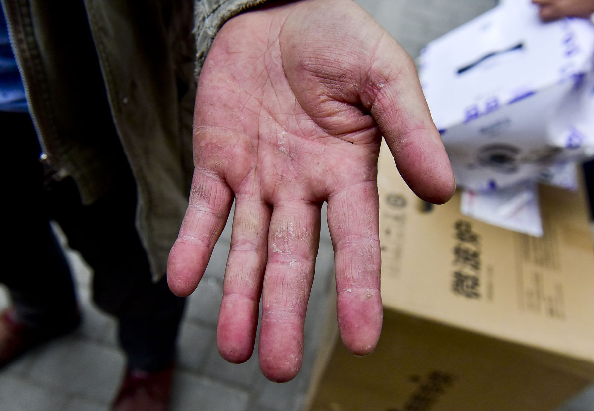 成都社区康复就业前景：机遇与挑战并存