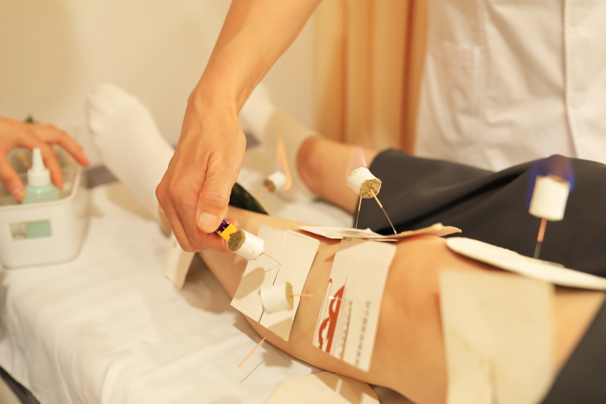 我想写一篇关于中美两国应用针灸现状的对比该如何引入美国针灸使用