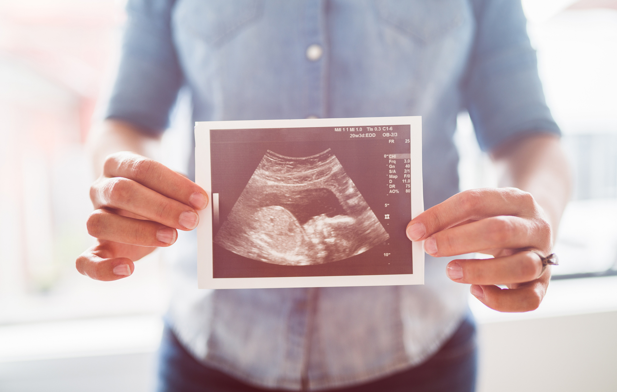 生化妊娠到底算不算流产?