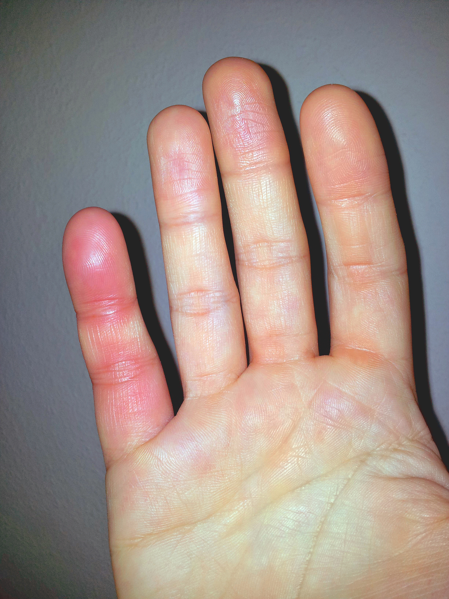 常见整容术语解析,术前了解术后放心