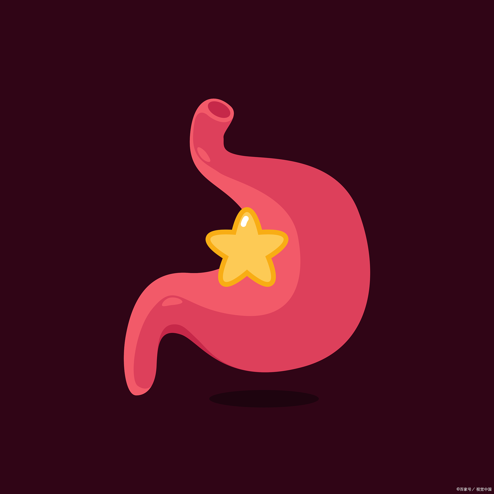 铝碳酸镁伤胃还是养胃?