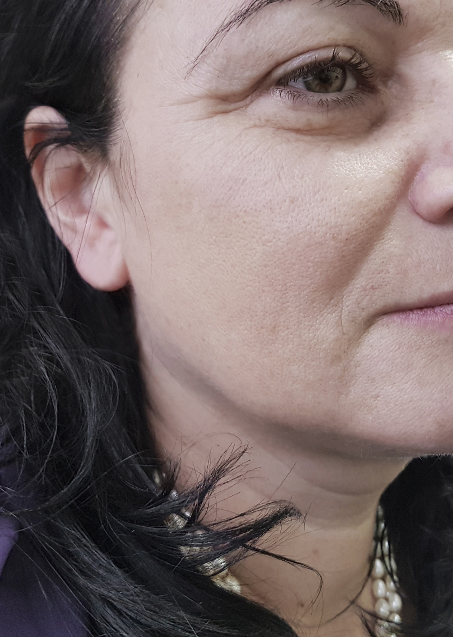 跨年创作挑战赛# 怎么减少脸上的皱纹?