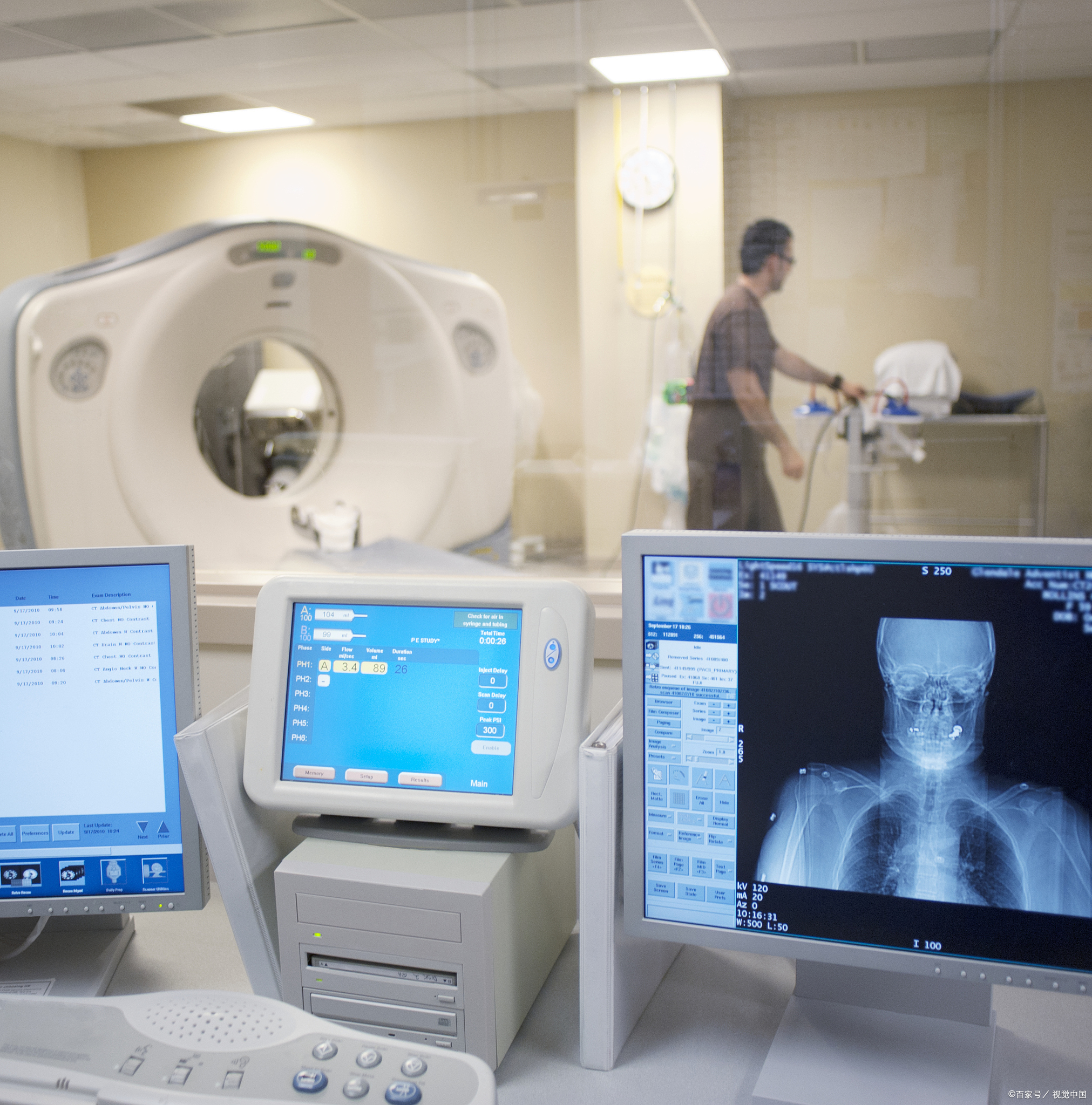 乳腺x线摄影主要有两种用途:乳腺癌筛査和乳腺癌临床诊断.