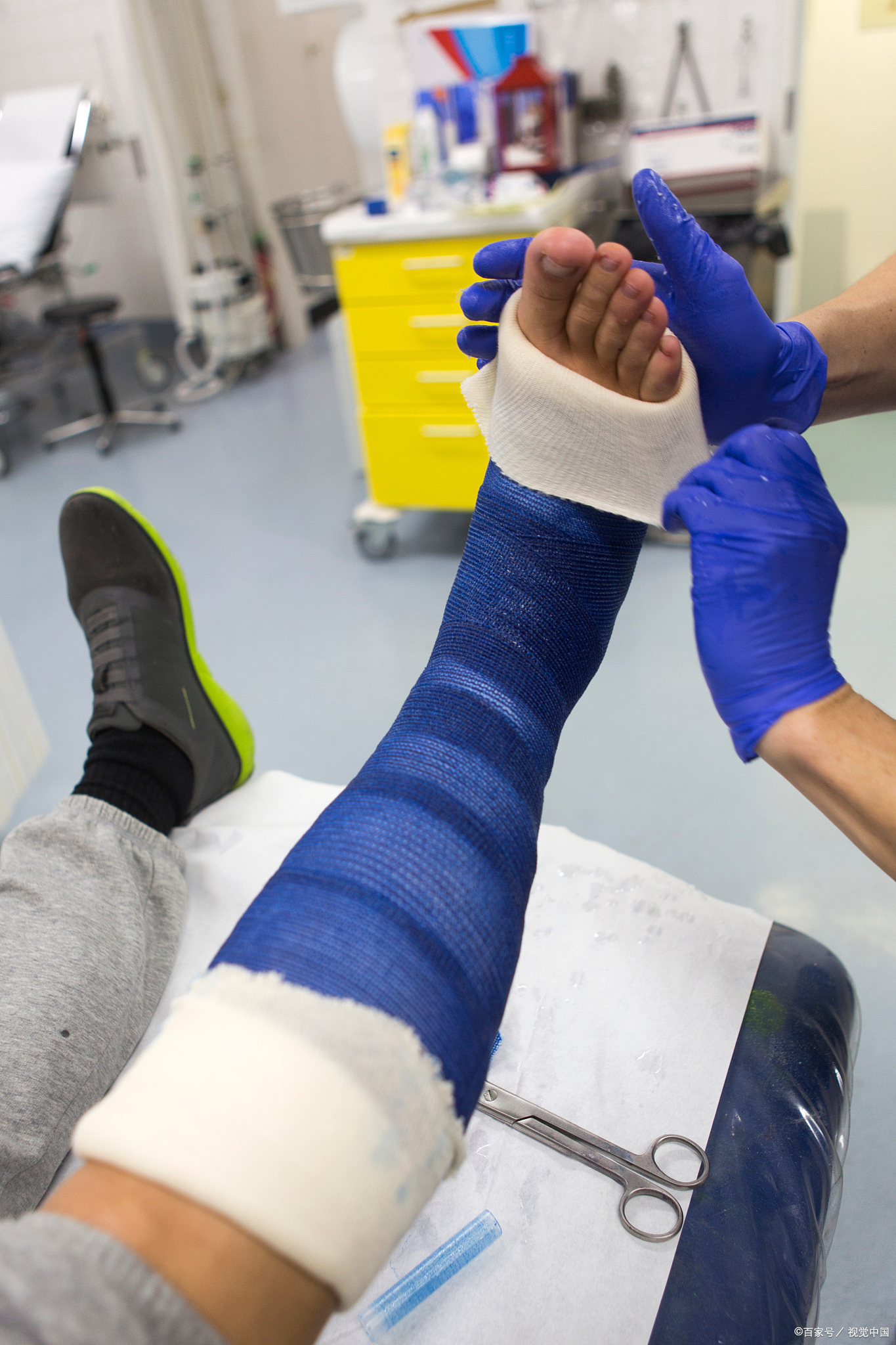 你以为骨裂只是骨头裂条缝打个石膏就能自愈?